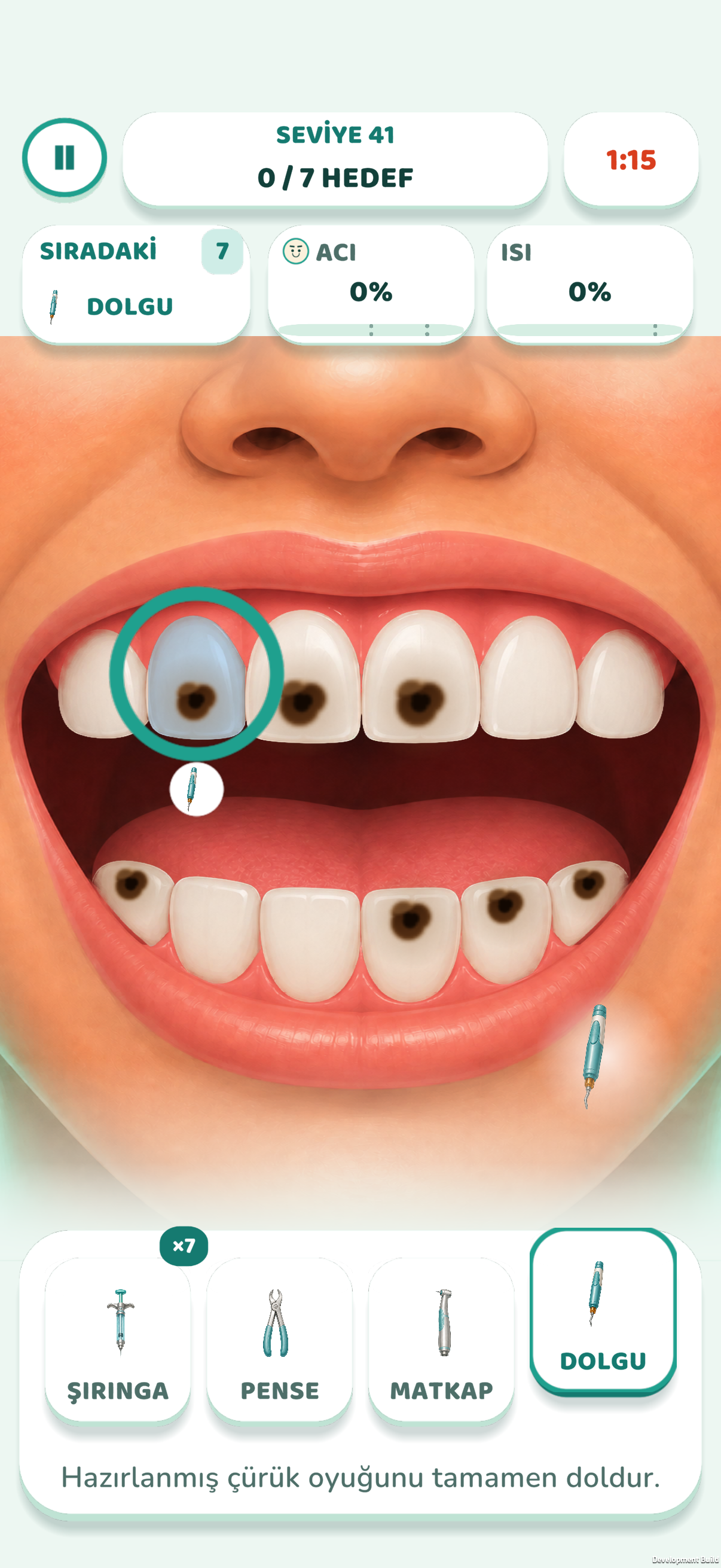 Dentist Master — dolgu / filling